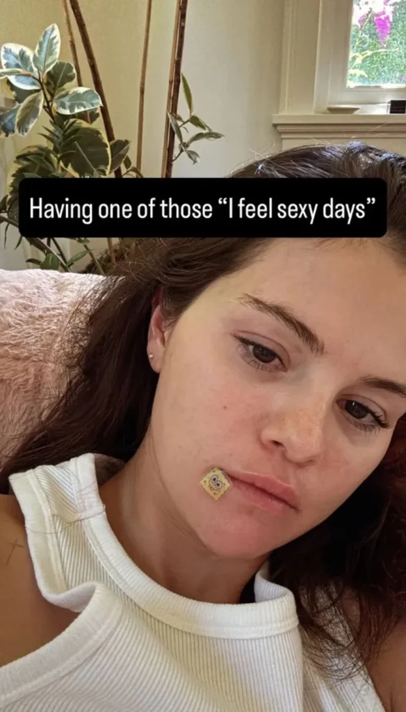 Selena Gomez: Πόζαρε με pimple patch 5 Selena Gomez: Πόζαρε με pimple patch