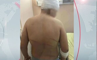 επίθεση 13χρονος Συκιές