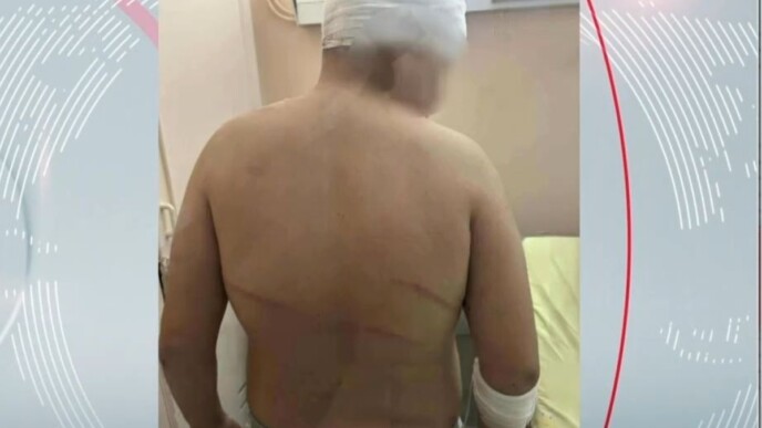 επίθεση 13χρονος Συκιές