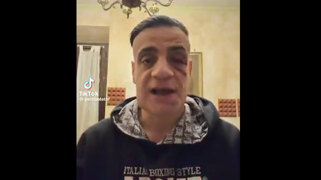 Επίθεση δέχθηκε στη Ρώμη YouTuber που καταγράφει πορτοφολάδες