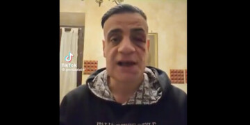 Επίθεση δέχθηκε στη Ρώμη YouTuber που καταγράφει πορτοφολάδες