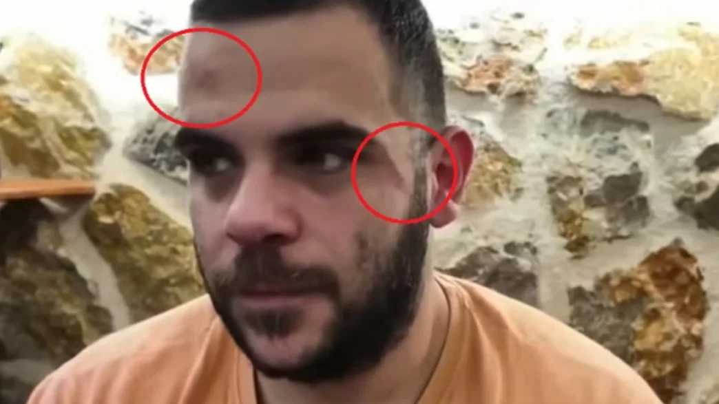 Ξυλοκόπησαν Youtuber σε live μετάδοση στα Γιάννενα