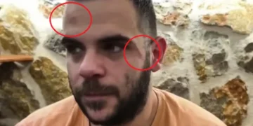 Ξυλοκόπησαν Youtuber σε live μετάδοση στα Γιάννενα