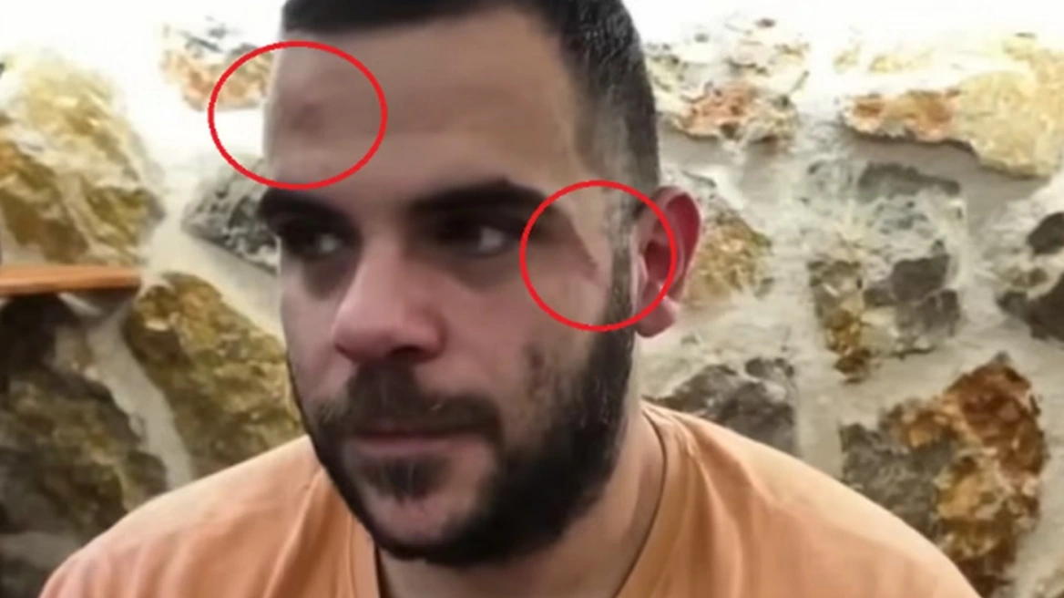 Ξυλοκόπησαν Youtuber σε live μετάδοση στα Γιάννενα