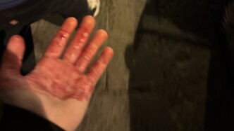 Τρόμος στη Νάπολι: Ενέδρα με μαχαίρια σε οπαδούς της Τσέλσι λίγο πριν το μεγάλο ματς