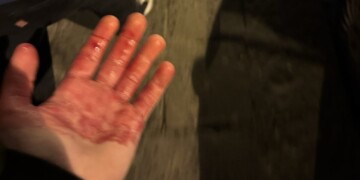 Τρόμος στη Νάπολι: Ενέδρα με μαχαίρια σε οπαδούς της Τσέλσι λίγο πριν το μεγάλο ματς