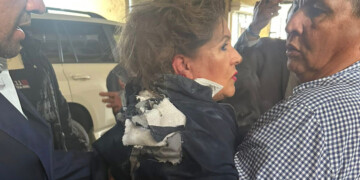 Σοκ στην Ονδούρα: Πέταξαν εκρηκτικό στο κεφάλι βουλευτή την ώρα που μιλούσε στις κάμερες