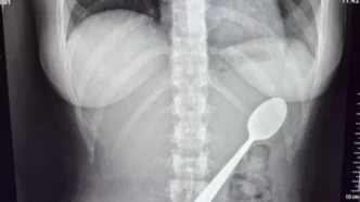 Απίστευτο ατύχημα στο Βέλγιο: Κατάπιε ολόκληρο κουτάλι εξαιτίας του σκύλου της!