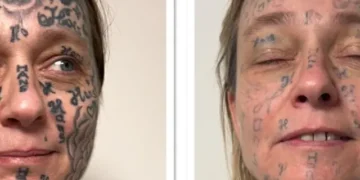 Ολλανδία: Κακοποιός κάλυψε με 250 τατουάζ το σώμα της συντρόφου του