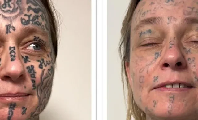 Ολλανδία: Κακοποιός κάλυψε με 250 τατουάζ το σώμα της συντρόφου του - newstok.gr