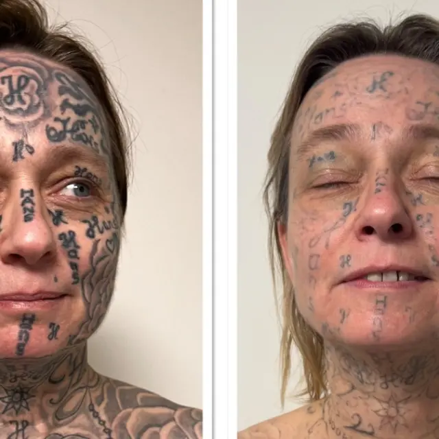 Ολλανδία: Κακοποιός κάλυψε με 250 τατουάζ το σώμα της συντρόφου του - newstok.gr