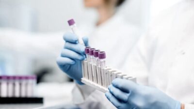Νέες οδηγίες για την έλλειψη σιδήρου: Αλλάζουν τα όρια της φερριτίνης για έγκαιρη διάγνωση