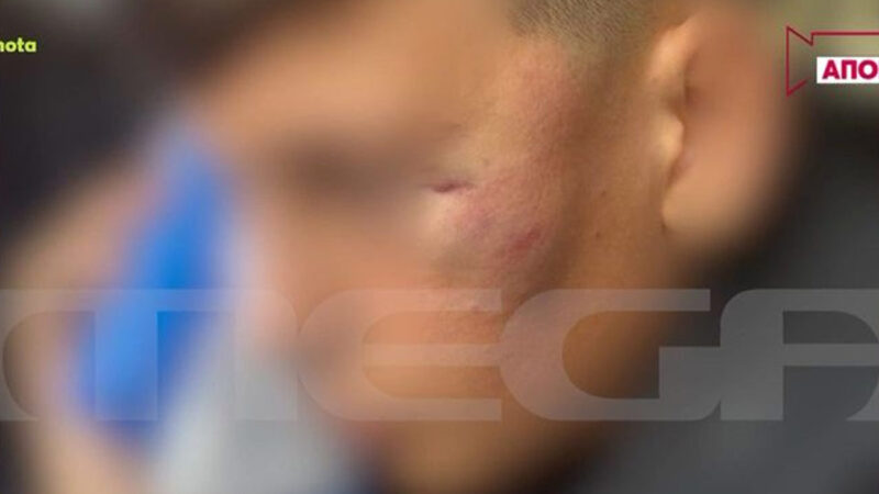 Ξυλοδαρμός ανήλικος Πειραιάς